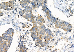 Invitrogen ATIC Polyclonal Antibody 100 &mu;L; Unconjugated:Antibodies,