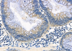Invitrogen ATIC Polyclonal Antibody 100 &mu;L; Unconjugated:Antibodies,