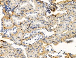 Invitrogen Ephrin B2 Polyclonal Antibody 100 &mu;L; Unconjugated:Antibodies,