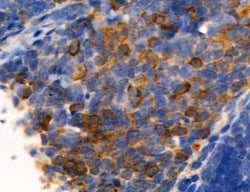 Invitrogen Ephrin B2 Polyclonal Antibody 100 &mu;L; Unconjugated:Antibodies,