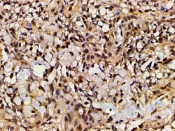 Invitrogen Ephrin B2 Polyclonal Antibody 100 &mu;L; Unconjugated:Antibodies,