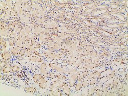 Invitrogen Ephrin B2 Polyclonal Antibody 100 &mu;L; Unconjugated:Antibodies,