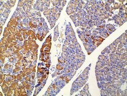 Invitrogen Ephrin B2 Polyclonal Antibody 100 &mu;L; Unconjugated:Antibodies,