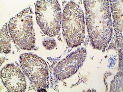 Invitrogen Ephrin B2 Polyclonal Antibody 100 &mu;L; Unconjugated:Antibodies,