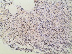 Invitrogen Ephrin B2 Polyclonal Antibody 100 &mu;L; Unconjugated:Antibodies,
