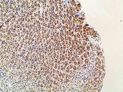 Invitrogen Ephrin B2 Polyclonal Antibody 100 &mu;L; Unconjugated:Antibodies,