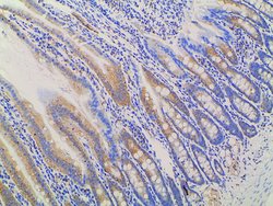 Invitrogen Ephrin B2 Polyclonal Antibody 100 &mu;L; Unconjugated:Antibodies,