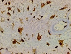 Invitrogen Ephrin B2 Polyclonal Antibody 100 &mu;L; Unconjugated:Antibodies,