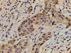 Invitrogen Ephrin B2 Polyclonal Antibody 100 &mu;L; Unconjugated:Antibodies,