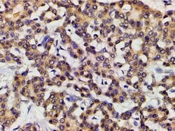 Invitrogen Ephrin B2 Polyclonal Antibody 100 &mu;L; Unconjugated:Antibodies,