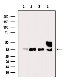 Invitrogen Ephrin B2 Polyclonal Antibody 100 &mu;L; Unconjugated:Antibodies,