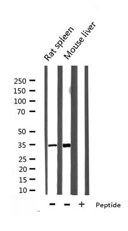 Invitrogen Ephrin B2 Polyclonal Antibody 100 &mu;L; Unconjugated:Antibodies,