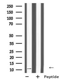 Invitrogen DAP Polyclonal Antibody 100 &mu;L; Unconjugated:Antibodies,