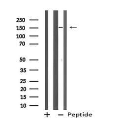 Invitrogen ZFYVE9 Polyclonal Antibody 100 &mu;L; Unconjugated:Antibodies,