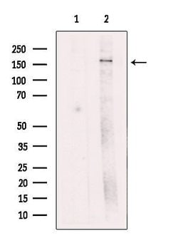 Invitrogen ZFYVE9 Polyclonal Antibody 100 &mu;L; Unconjugated:Antibodies,