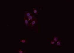 Invitrogen PP2A alpha/beta Polyclonal Antibody 100 &mu;L; Unconjugated:Antibodies,