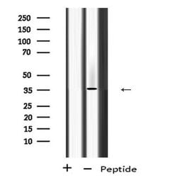 Invitrogen PP2A alpha/beta Polyclonal Antibody 100 &mu;L; Unconjugated:Antibodies,