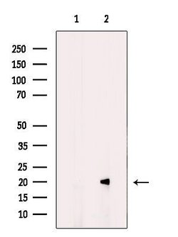 Invitrogen MRAP Polyclonal Antibody 100 μL; Unconjugated:Antibodies,