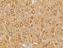 Invitrogen MAP1A Polyclonal Antibody 100 &mu;L; Unconjugated:Antibodies,