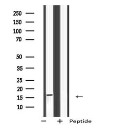 Invitrogen RT28 Polyclonal Antibody 100 &mu;L; Unconjugated:Antibodies,