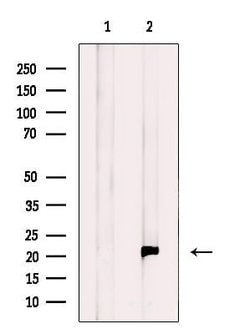 Invitrogen RT28 Polyclonal Antibody 100 &mu;L; Unconjugated:Antibodies,