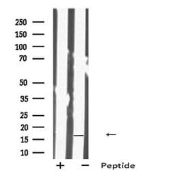 Invitrogen IMMP1L Polyclonal Antibody 100 &mu;L; Unconjugated:Antibodies,