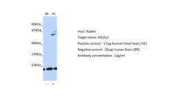 Invitrogen ADSSL1 Polyclonal Antibody 100 &mu;L; Unconjugated:Antibodies,