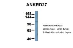 Invitrogen ANKRD27 Polyclonal Antibody 100 &mu;L; Unconjugated:Antibodies,