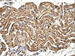 Invitrogen ATP Synthase beta Polyclonal Antibody 100 &mu;L; Unconjugated:Antibodies,