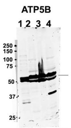 Invitrogen ATP Synthase beta Polyclonal Antibody 100 &mu;L; Unconjugated:Antibodies,