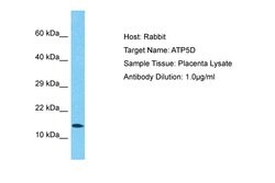 Invitrogen ATP5D Polyclonal Antibody 100 μL; Unconjugated:Antibodies,