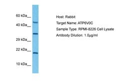 Invitrogen ATP6V0C Polyclonal Antibody 100 &mu;L; Unconjugated:Antibodies,