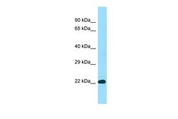 Invitrogen BLOC1S3 Polyclonal Antibody 100 &mu;L; Unconjugated:Antibodies,