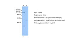 Invitrogen alpha COP Polyclonal Antibody 100 &mu;L; Unconjugated:Antibodies,