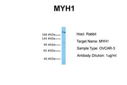 Invitrogen Myosin Skeletal Muscle Polyclonal Antibody 100 &mu;L; Unconjugated:Antibodies,