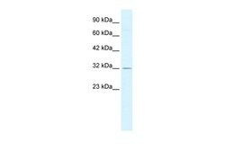 Invitrogen PSMD14 Polyclonal Antibody 100 &mu;L; Unconjugated:Antibodies,