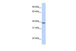 Invitrogen SLC25A42 Polyclonal Antibody 100 &mu;L; Unconjugated:Antibodies,