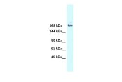 Invitrogen SNRNP200 Polyclonal Antibody 100 &mu;L; Unconjugated:Antibodies,