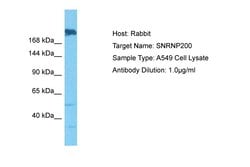 Invitrogen SNRNP200 Polyclonal Antibody 100 &mu;L; Unconjugated:Antibodies,