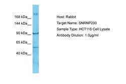 Invitrogen SNRNP200 Polyclonal Antibody 100 &mu;L; Unconjugated:Antibodies,