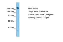 Invitrogen SNRNP200 Polyclonal Antibody 100 &mu;L; Unconjugated:Antibodies,
