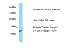 Invitrogen SPRR2A Polyclonal Antibody 100 μL; Unconjugated:Antibodies,