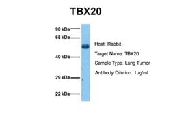 Invitrogen TBX20 Polyclonal Antibody 100 &mu;L; Unconjugated:Antibodies,
