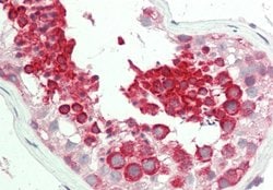Invitrogen TEX264 Polyclonal Antibody 100 &mu;L; Unconjugated:Antibodies,