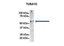 Invitrogen TUBA1C Polyclonal Antibody 100 μL; Unconjugated:Antibodies,