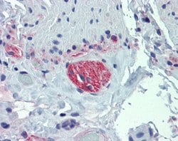 Invitrogen TUBB2A Polyclonal Antibody 100 μL; Unconjugated:Antibodies,