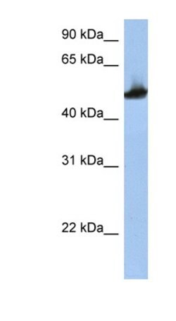 Invitrogen TUBB2A Polyclonal Antibody 100 μL; Unconjugated:Antibodies,