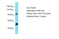 Invitrogen KIAA1429 Polyclonal Antibody 100 &mu;L; Unconjugated:Antibodies,