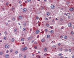 Invitrogen Acid Phosphatase 2 Polyclonal Antibody 100 μL; Unconjugated:Antibodies,