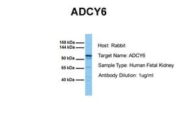 Invitrogen Adenylate Cyclase 6 Polyclonal Antibody 100 &mu;L; Unconjugated:Antibodies,